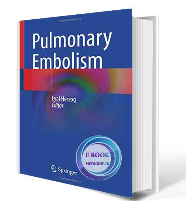 دانلود کتاب Pulmonary Embolism 1st ed. 2022 Edition(ORIGINAL PDF)
